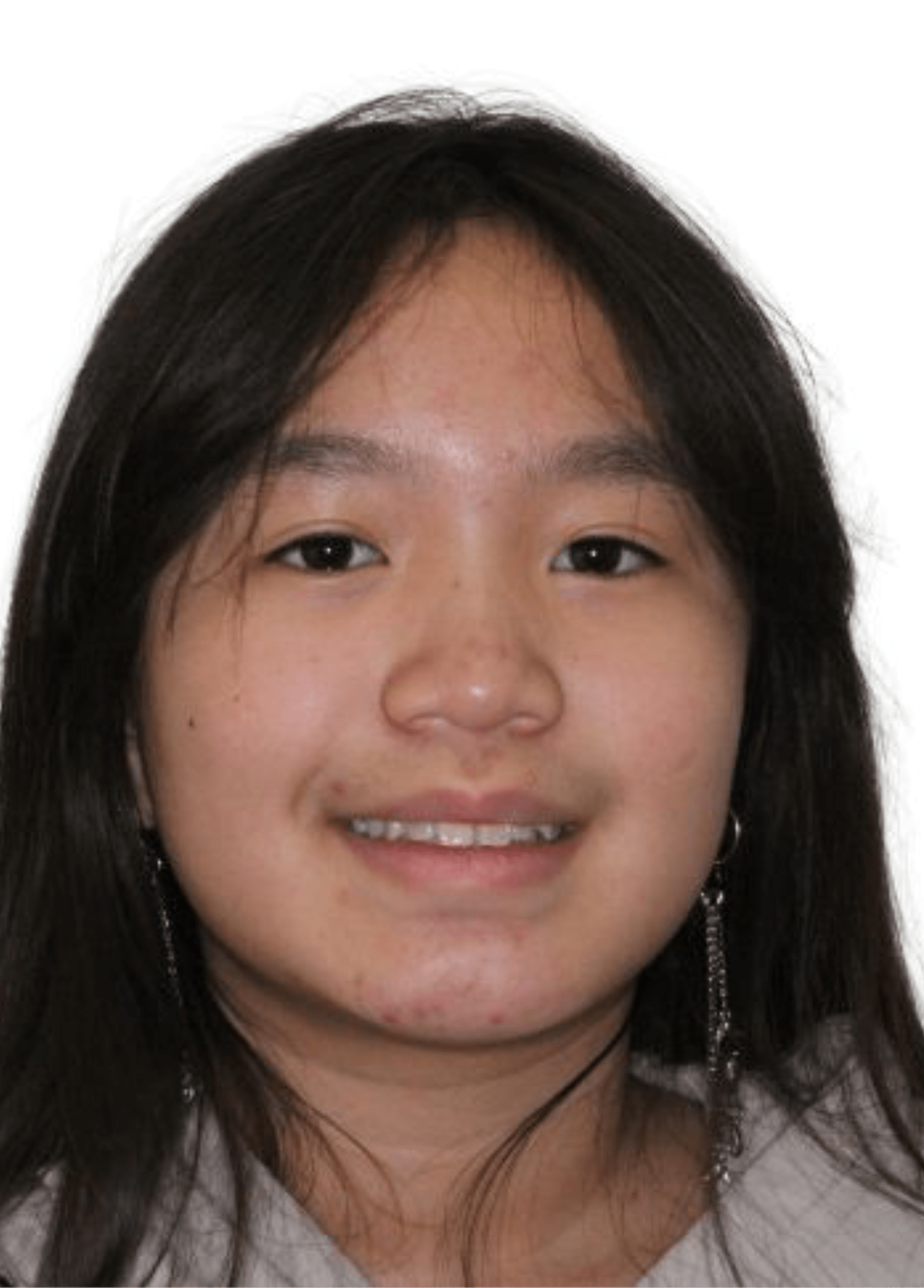 orthodontist tipton