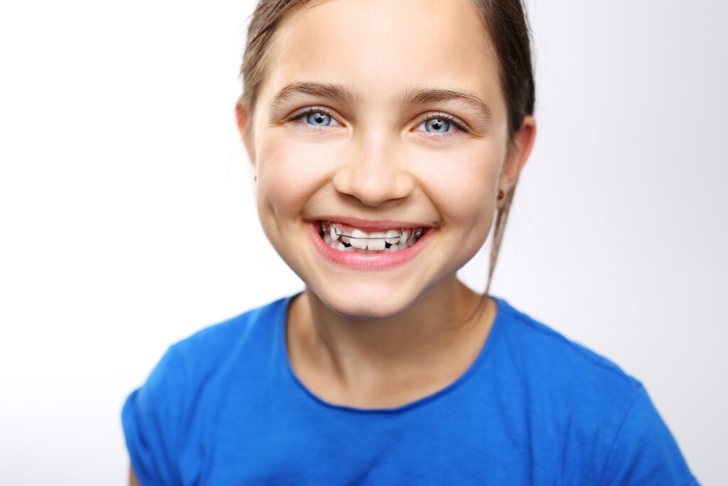 What Is a Palatal Expander and How Does It Work
