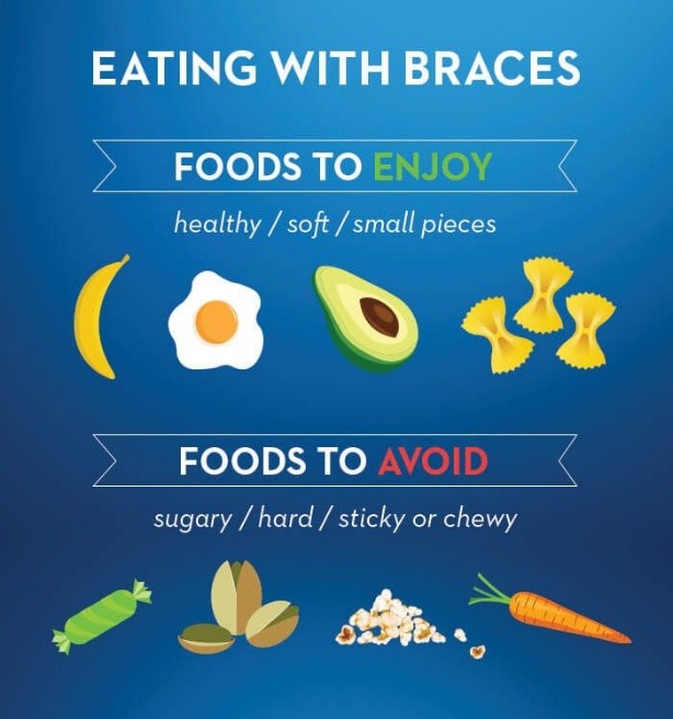 Foods to Enjoy and Foods to Avoid While Wearing Braces