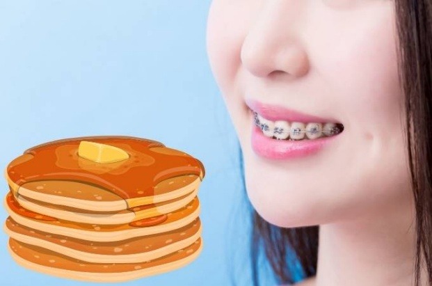 Foods to Enjoy and Foods to Avoid While Wearing Braces