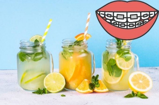 Foods to Enjoy and Foods to Avoid While Wearing Braces