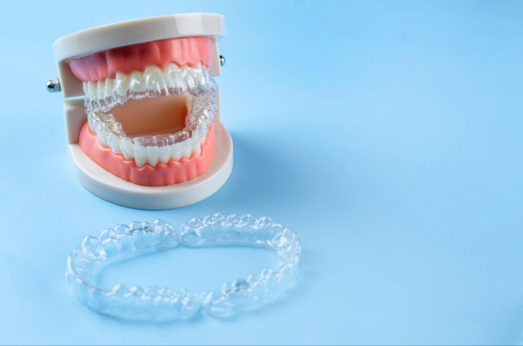 Clear Aligner Technology and How It Shapes Your Treatment