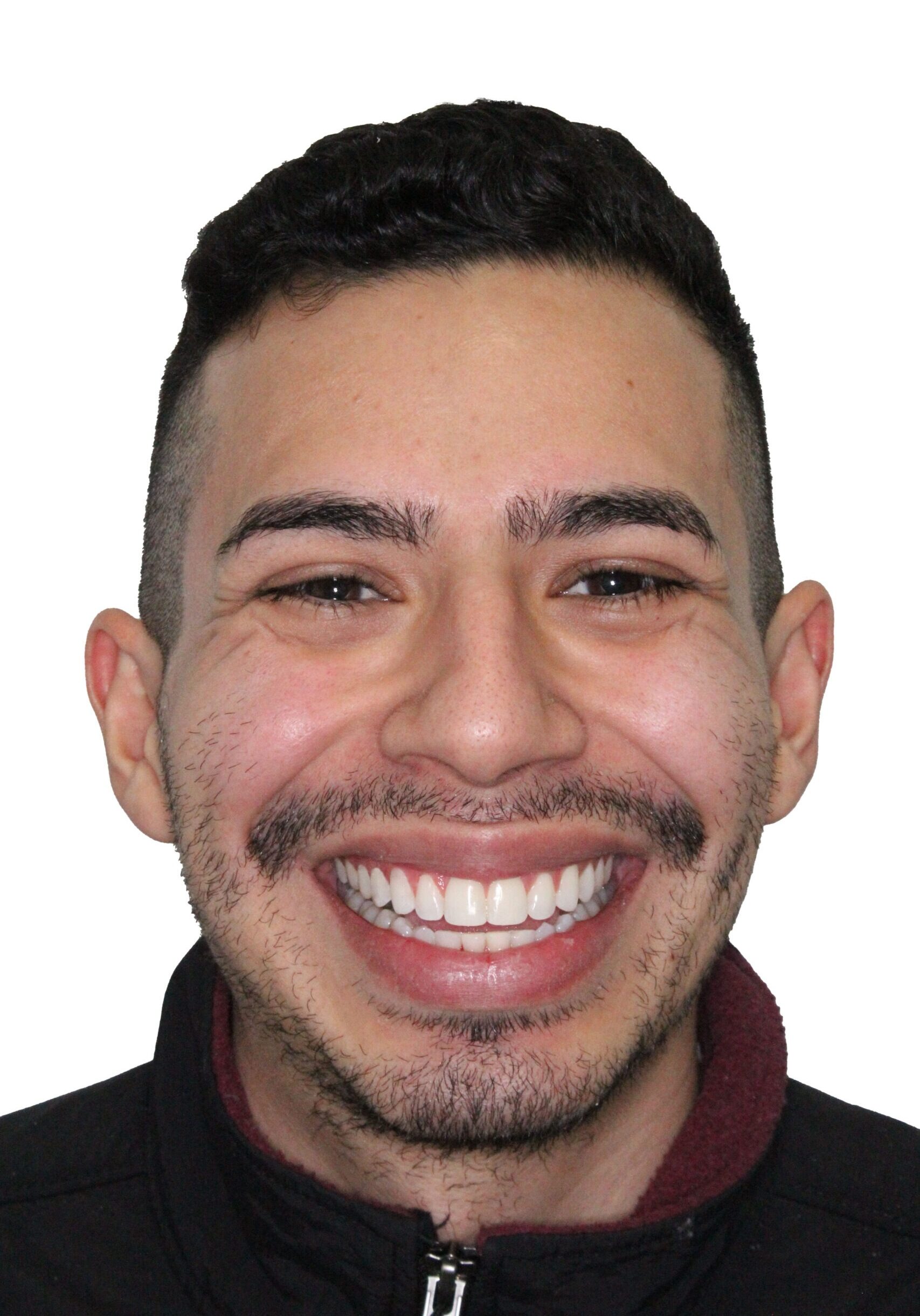 orthodontist tipton