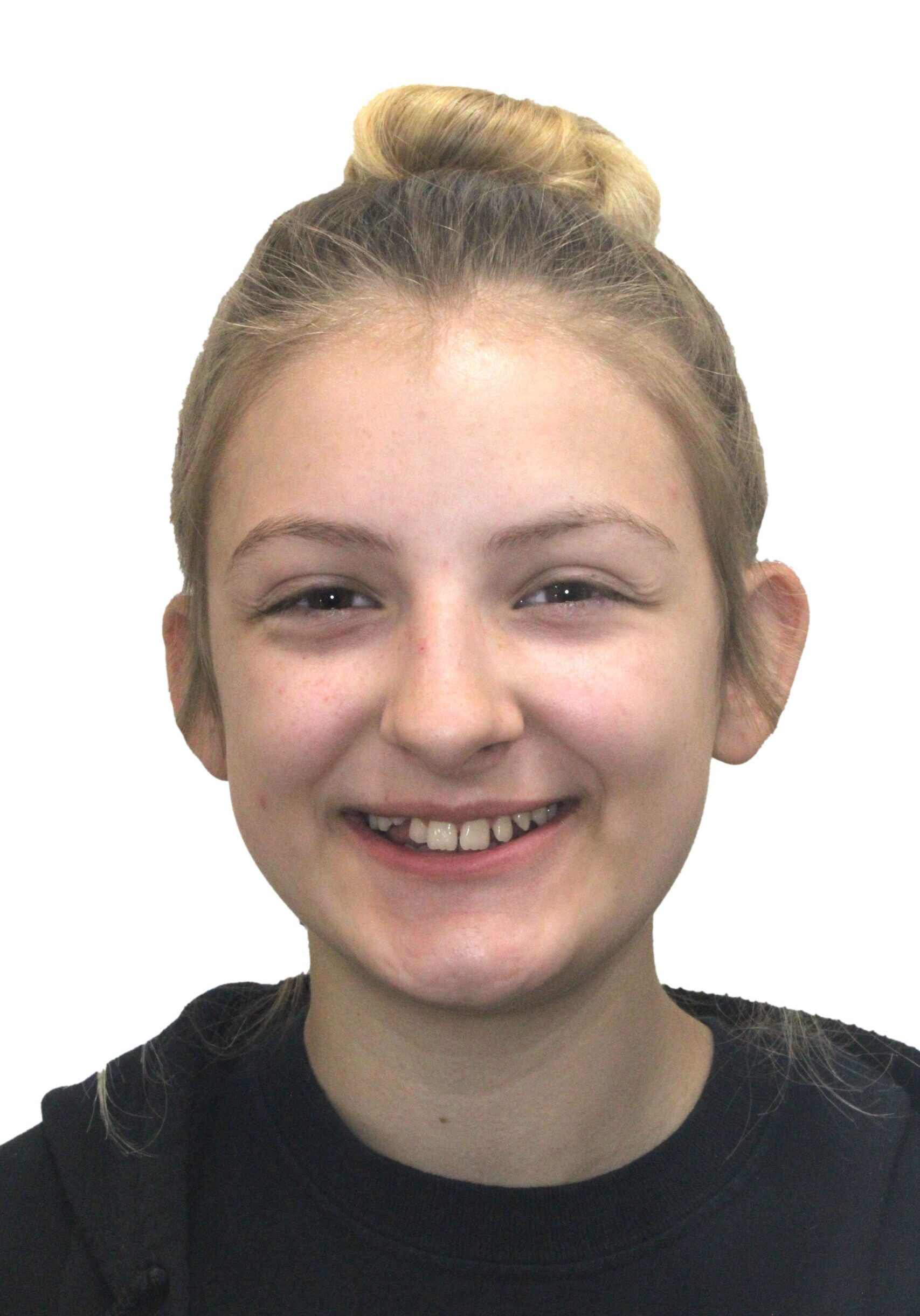 orthodontist tipton