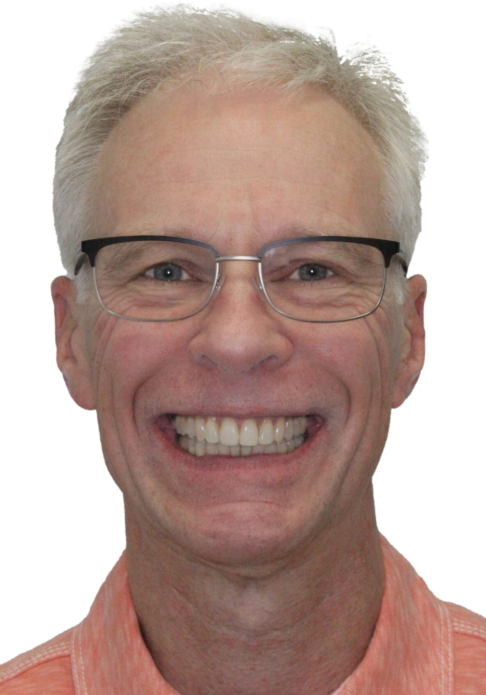 orthodontist tipton