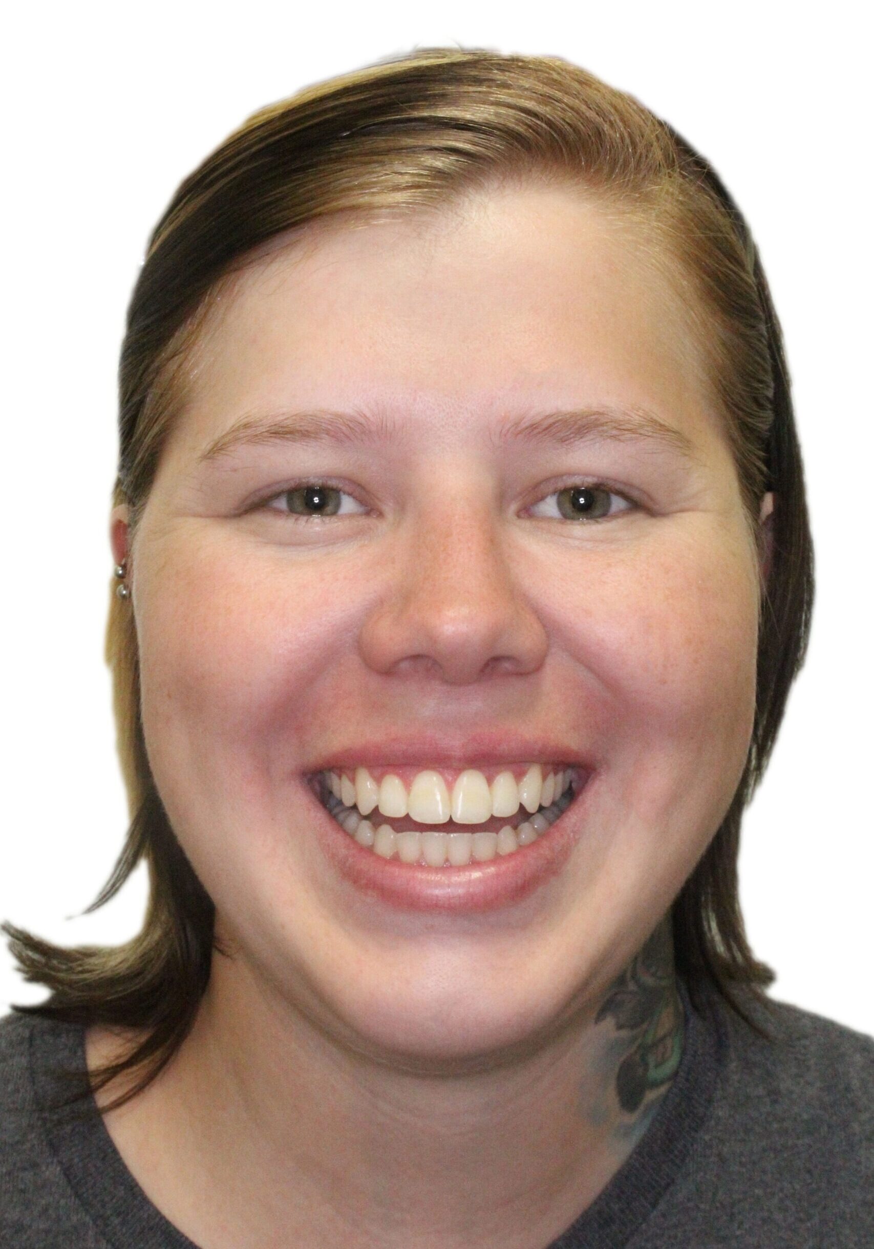orthodontist tipton