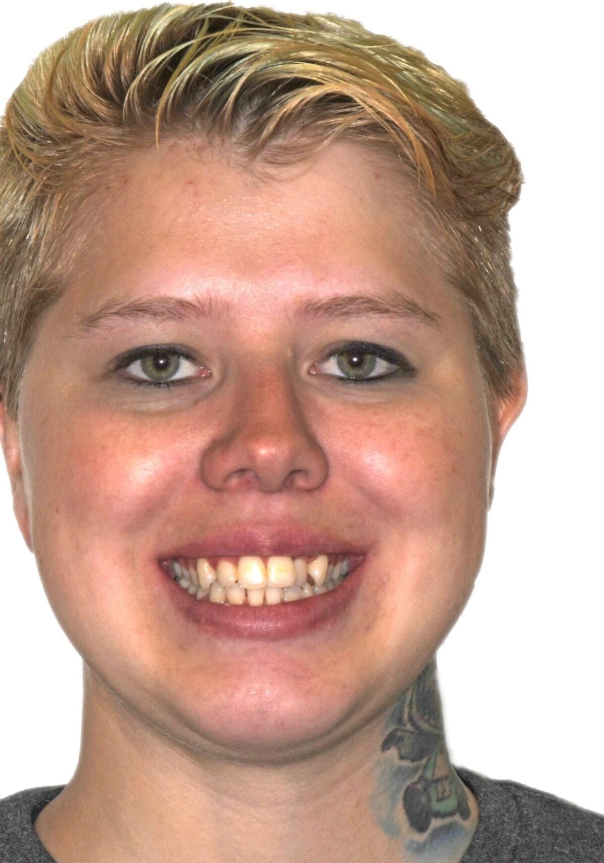 orthodontist tipton