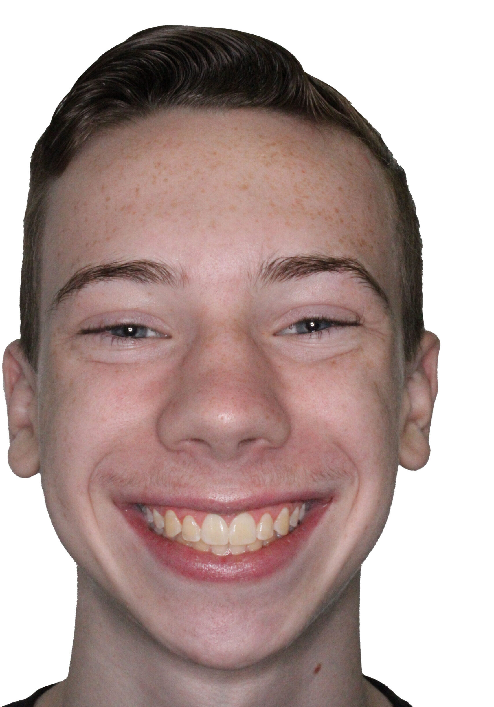 orthodontist tipton