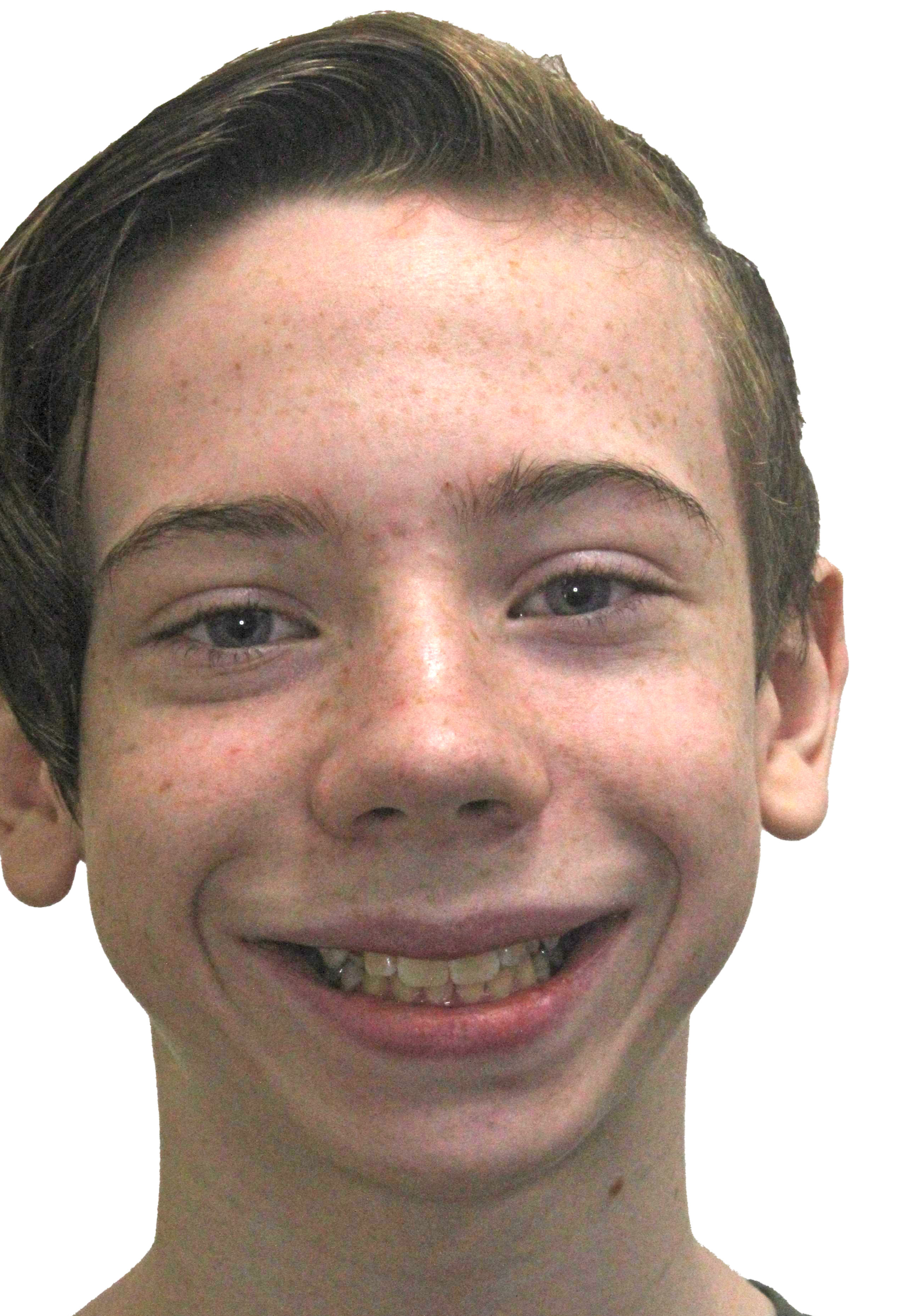 orthodontist tipton