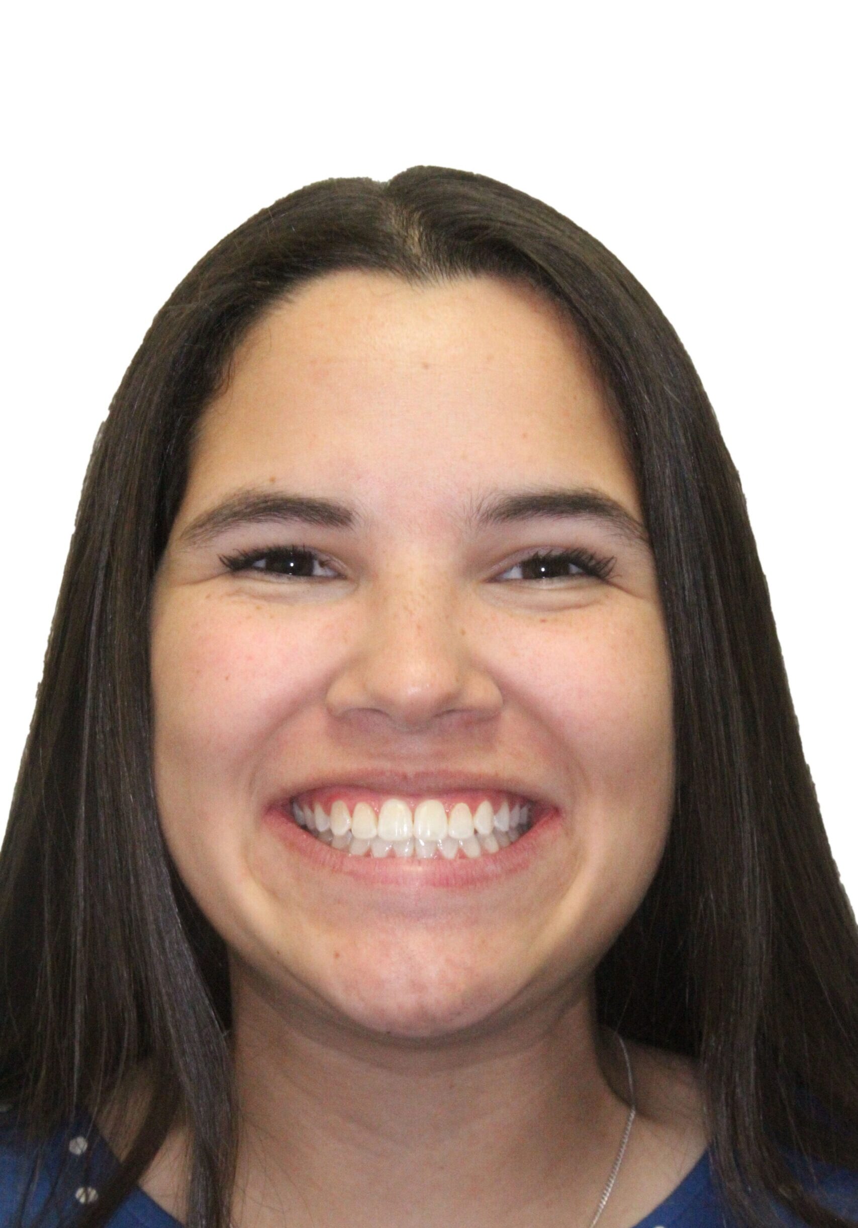 orthodontist tipton