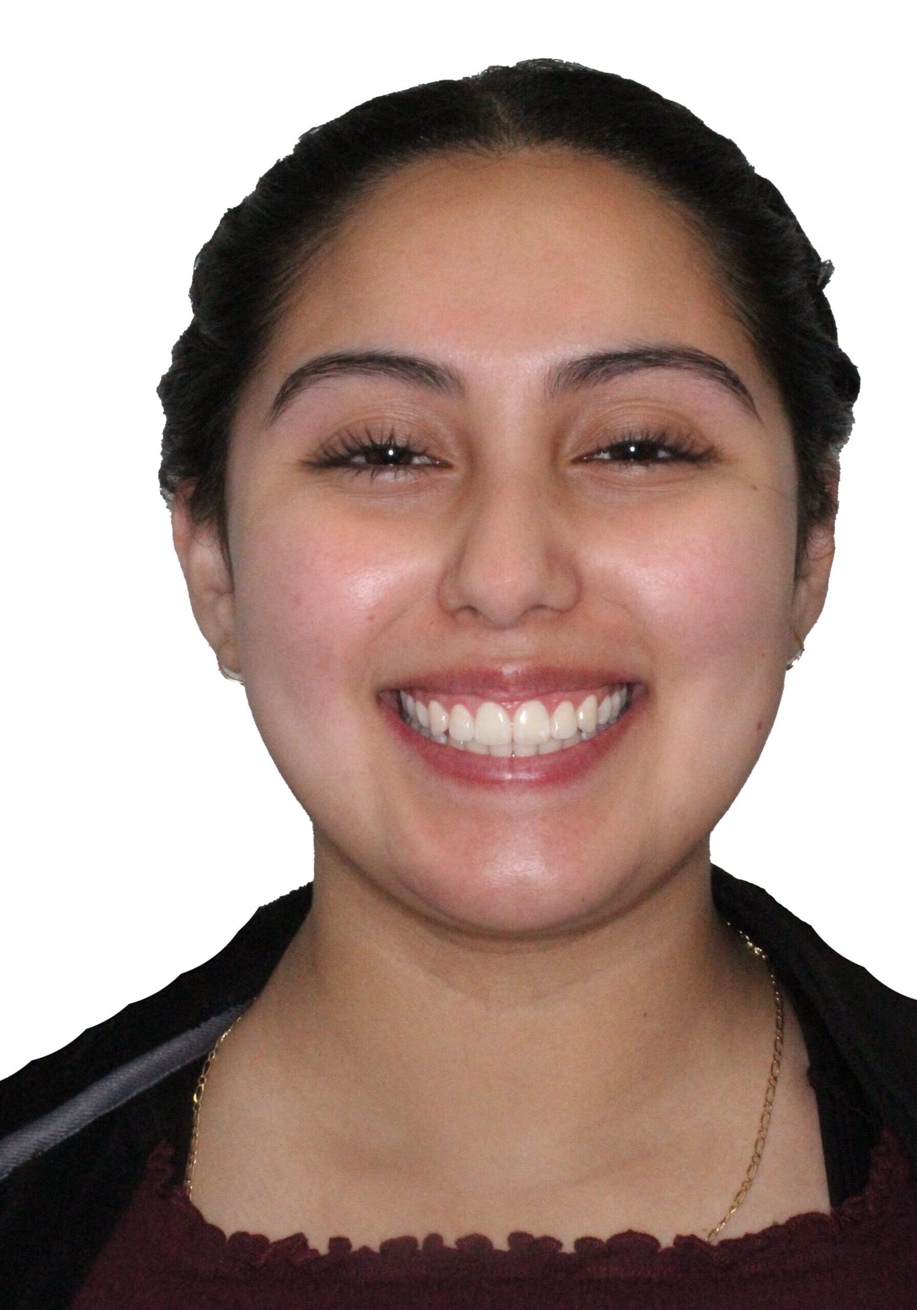 orthodontist tipton