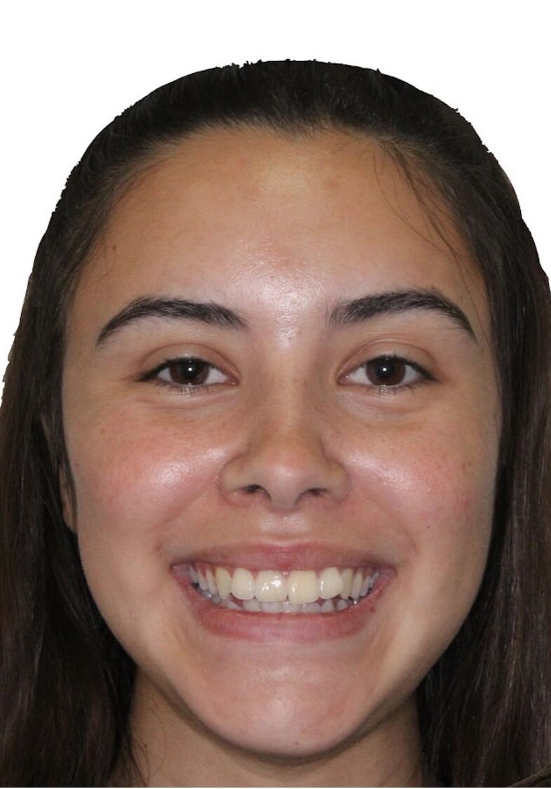 orthodontist tipton