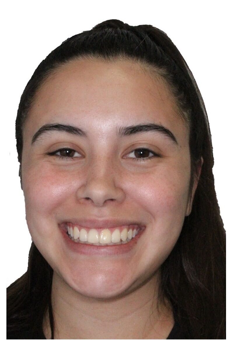 orthodontist tipton