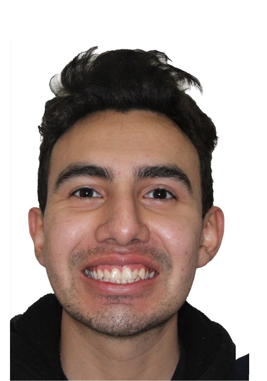 orthodontist tipton