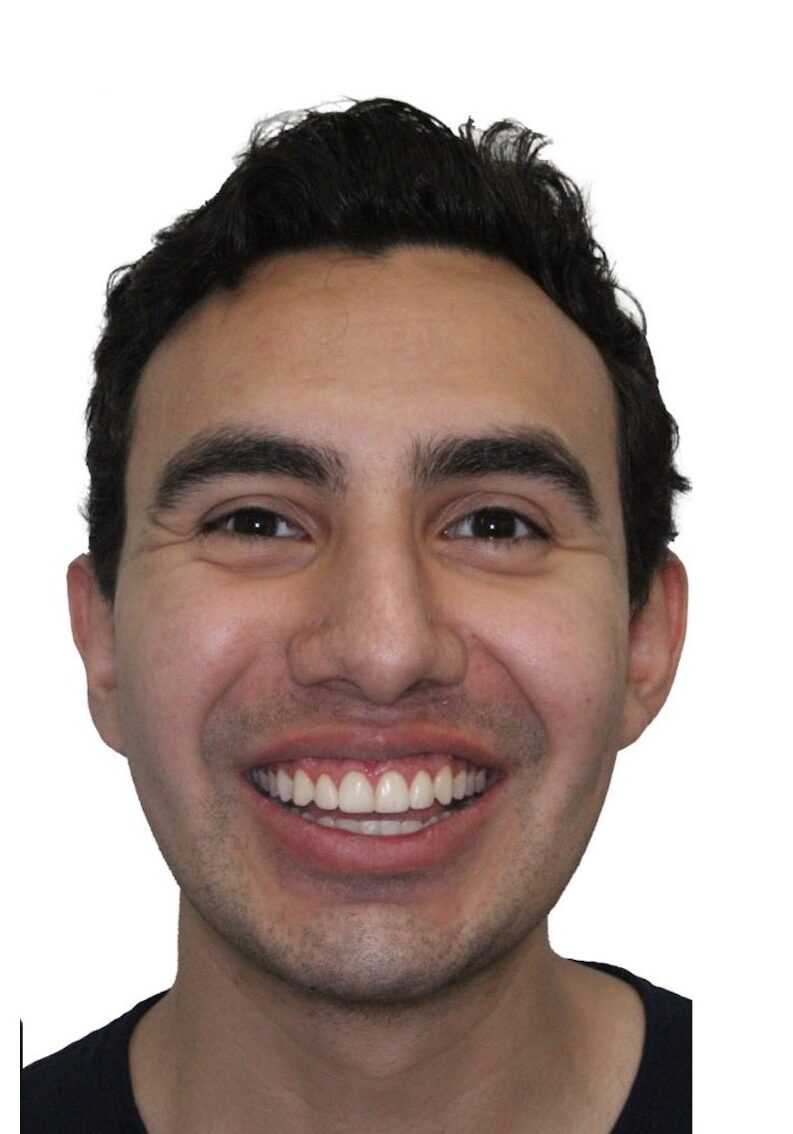 orthodontist tipton