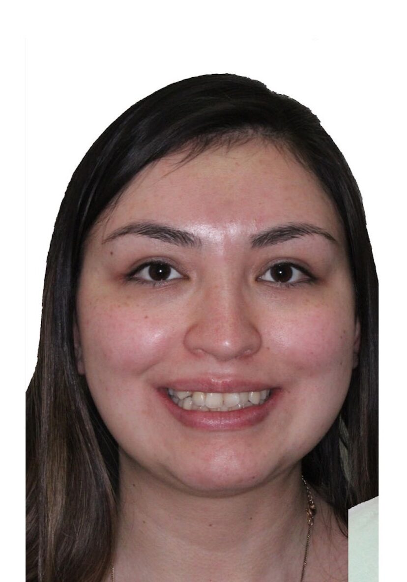 orthodontist tipton