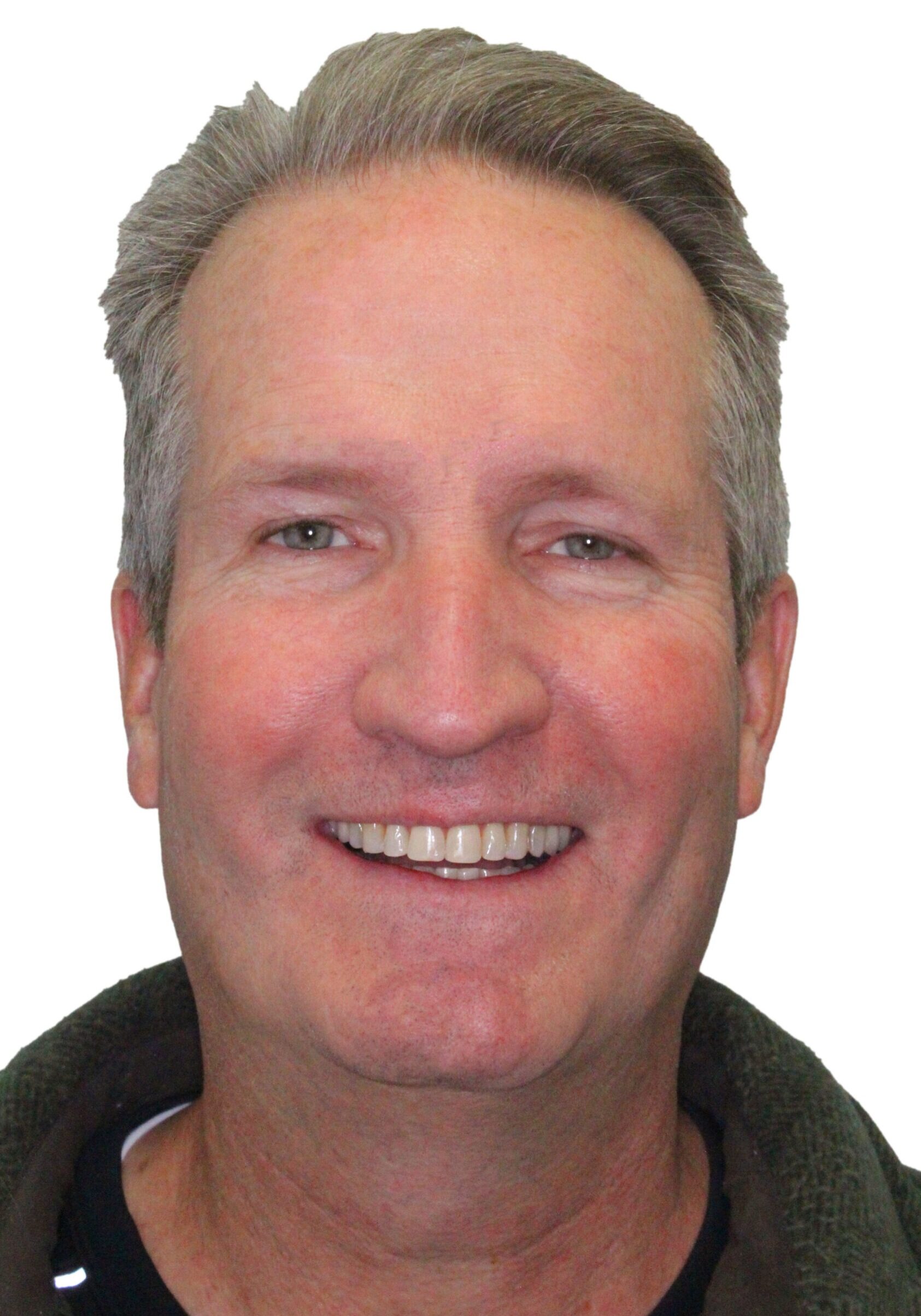 orthodontist tipton