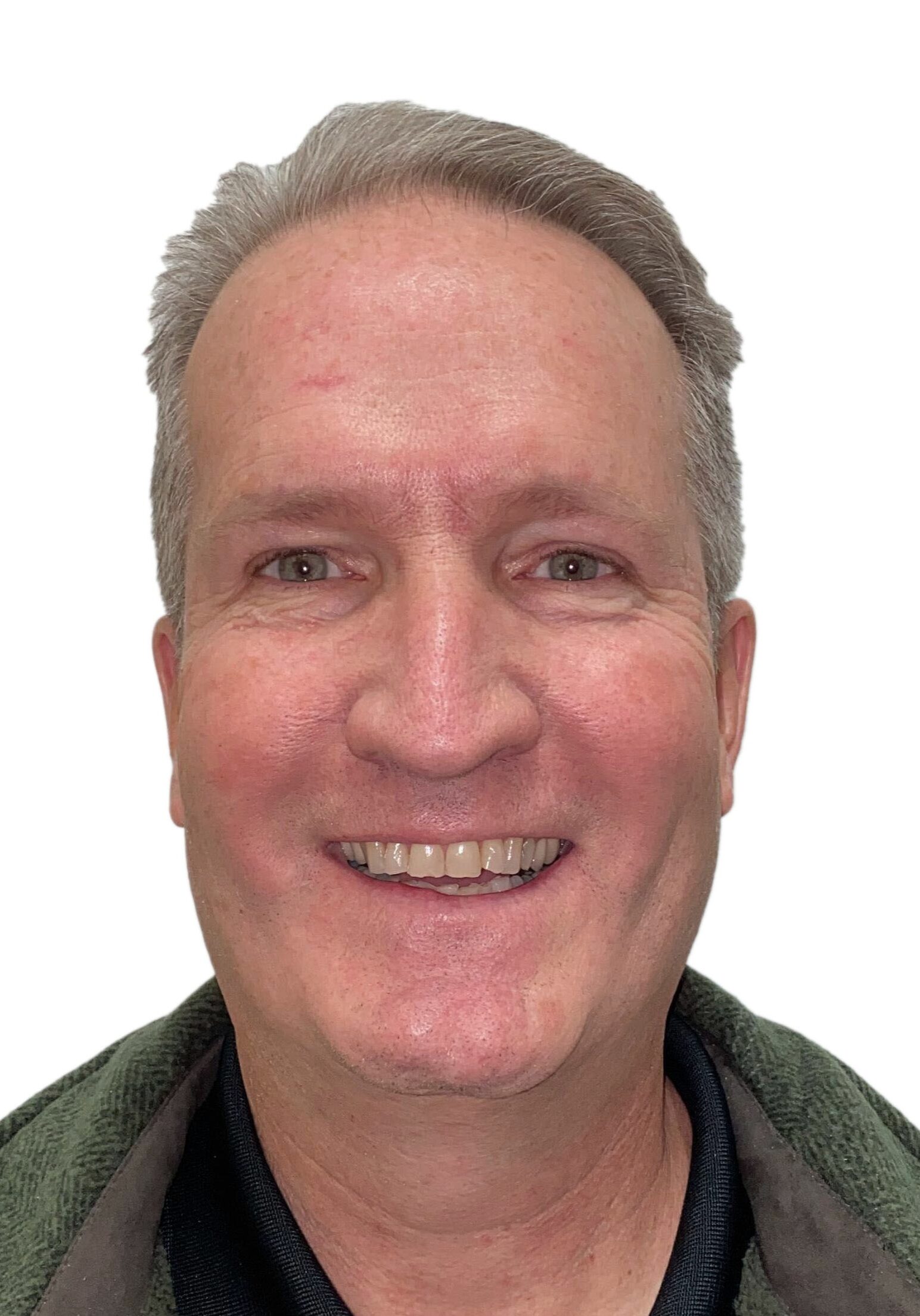 orthodontist tipton