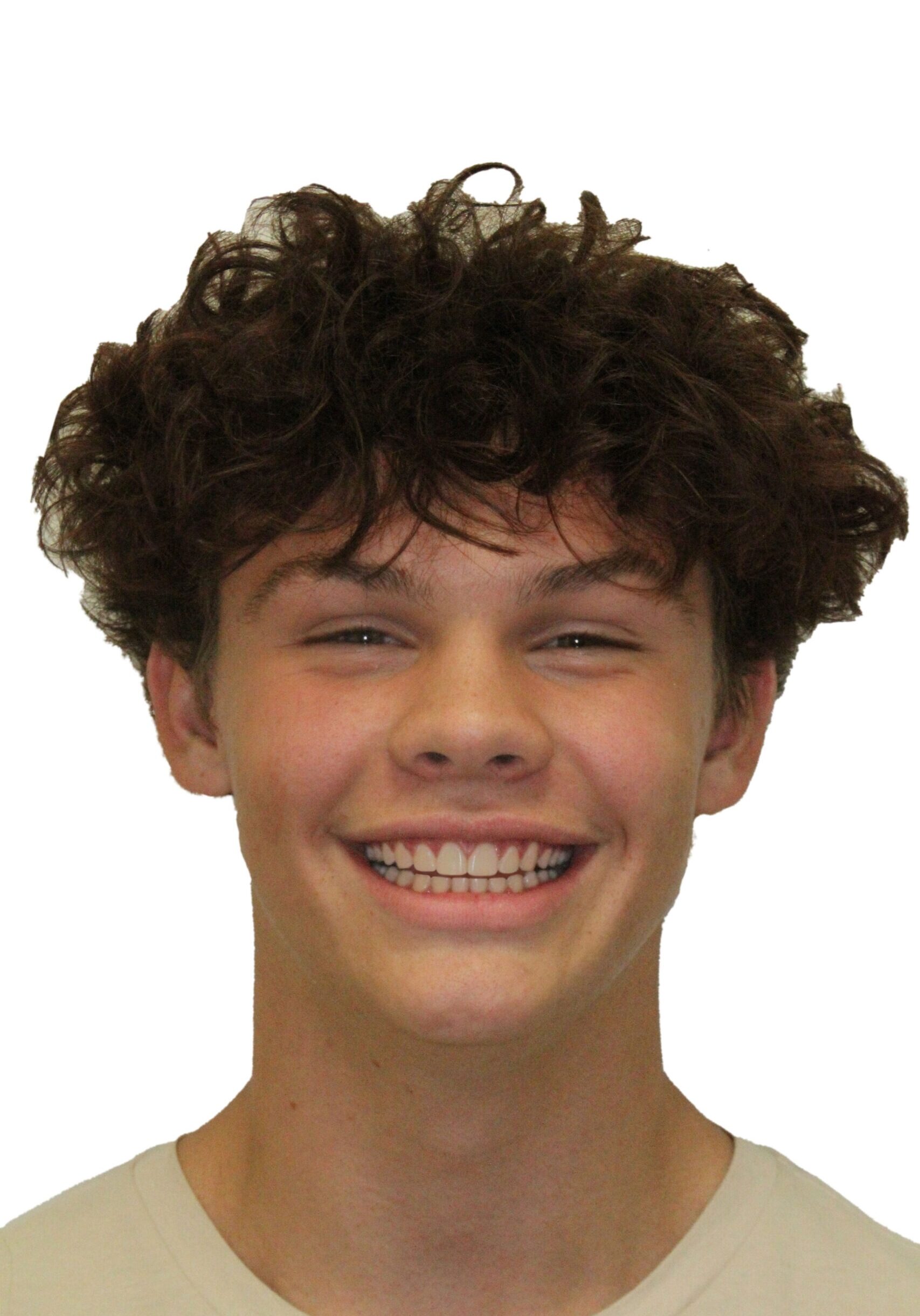 orthodontist tipton