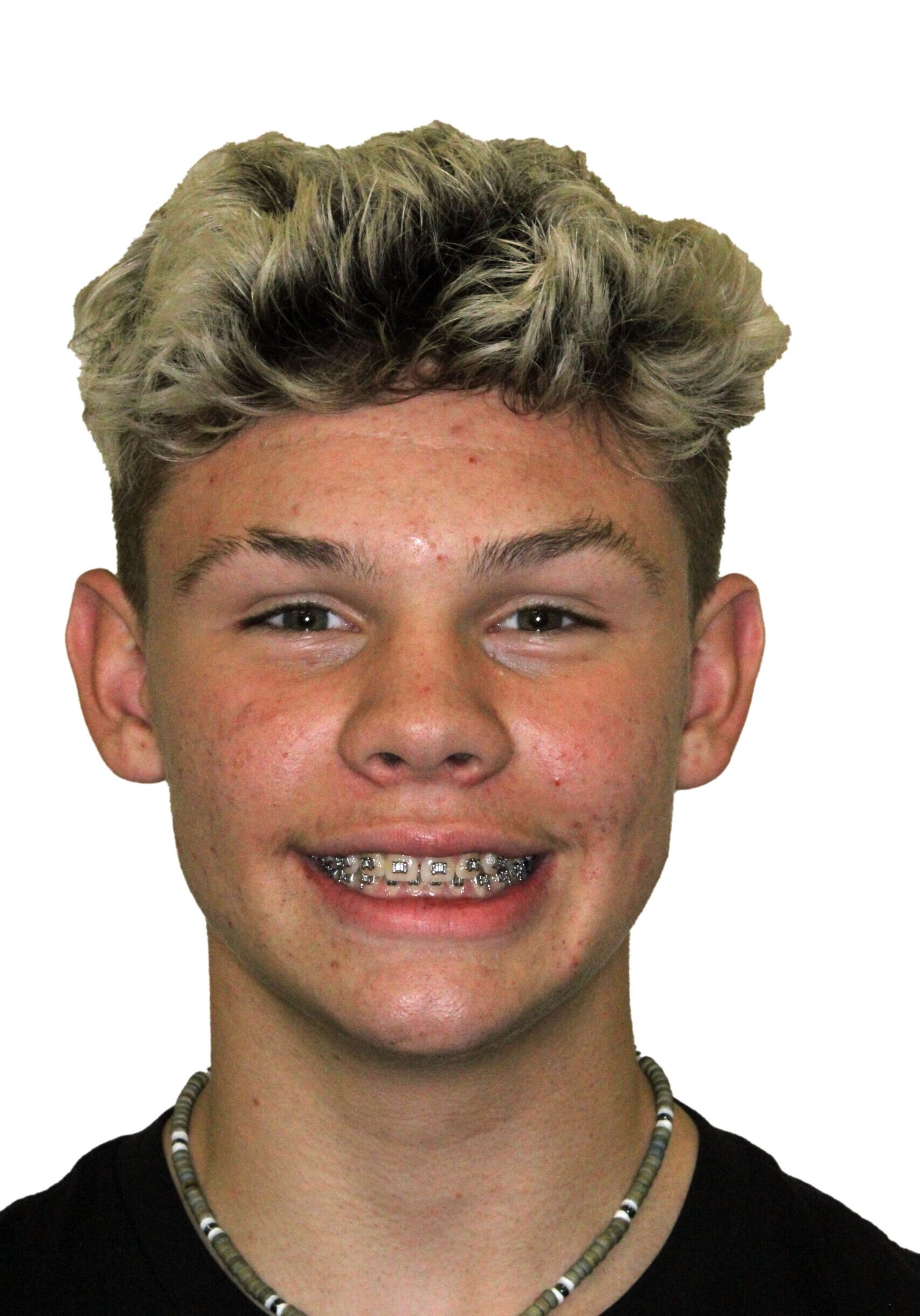 orthodontist tipton