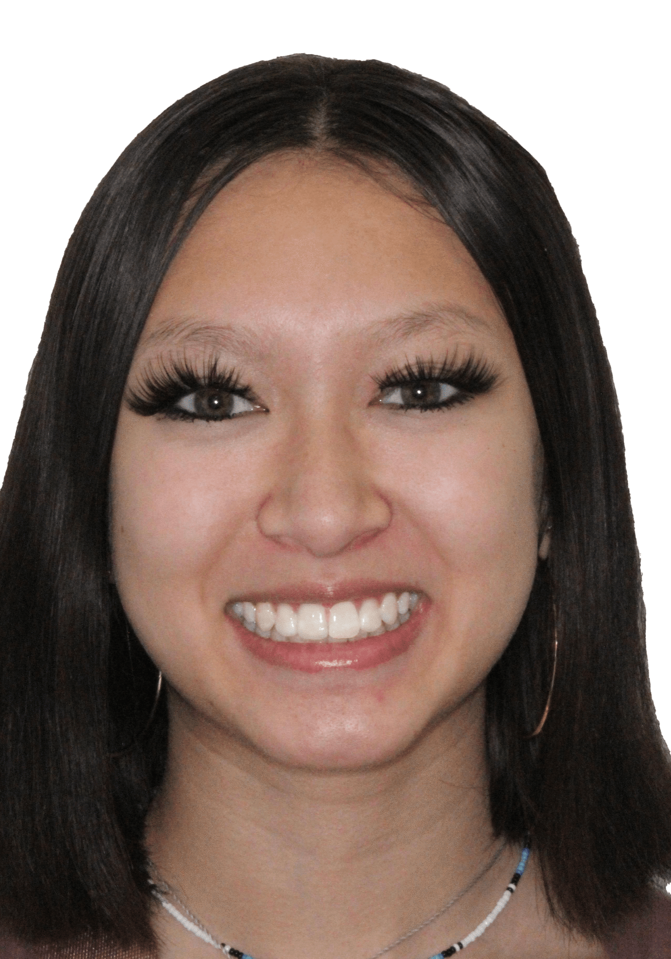 orthodontist tipton