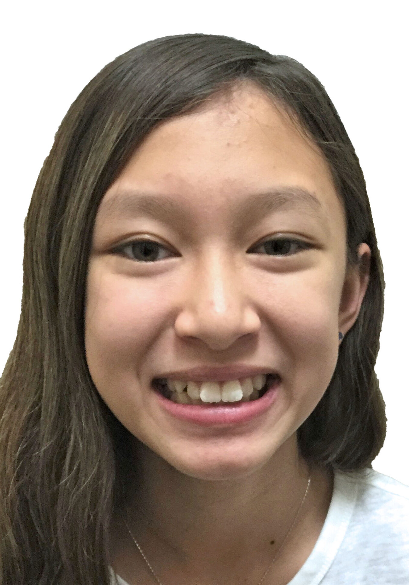 orthodontist tipton