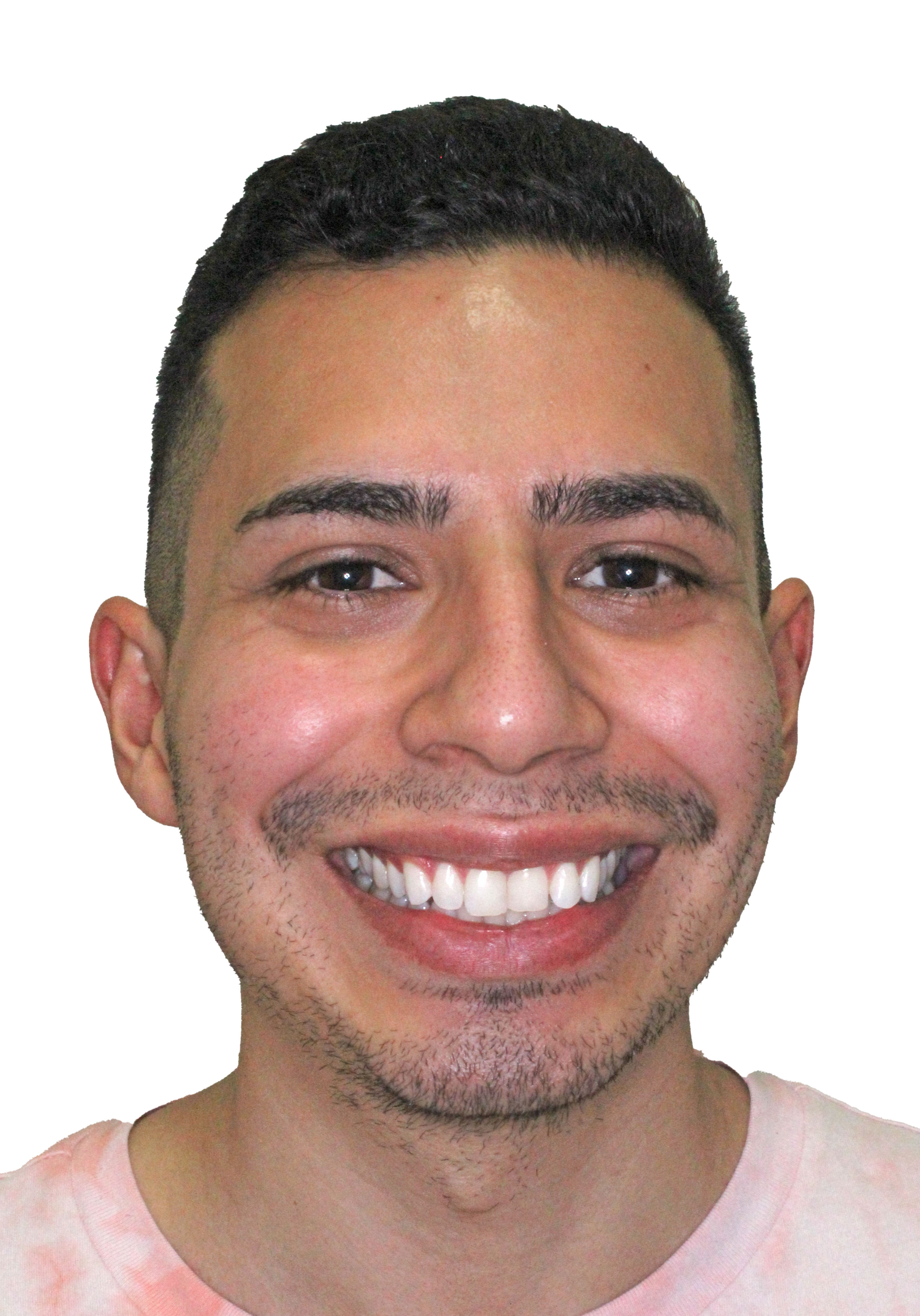 orthodontist tipton